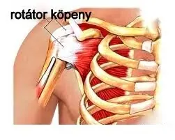 rotátor köpeny szindróma kezelése